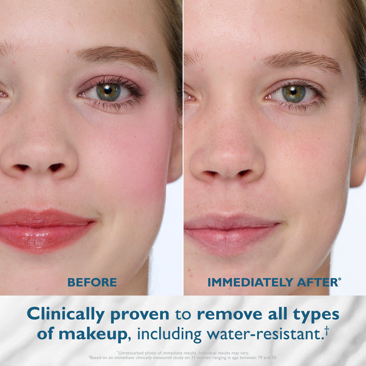 Before and after comparison of a person's face with text indicating makeup removal.