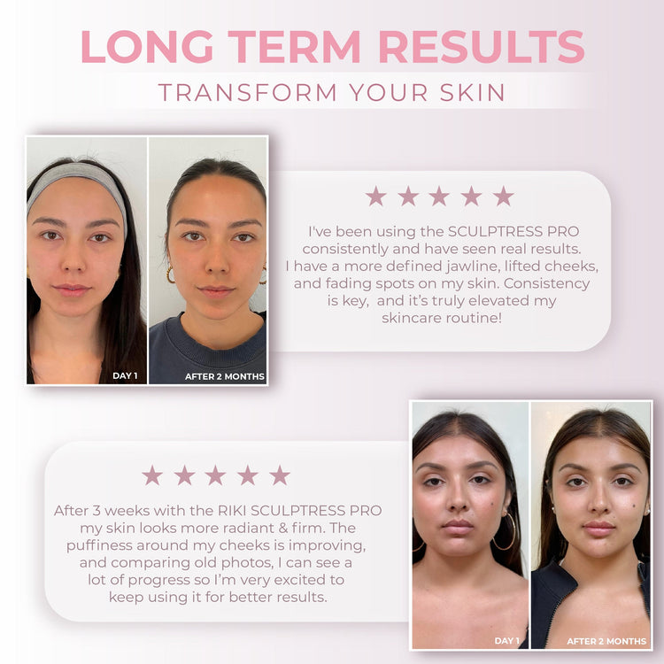 Before and after skin improvement results using a skincare product with user testimonials.