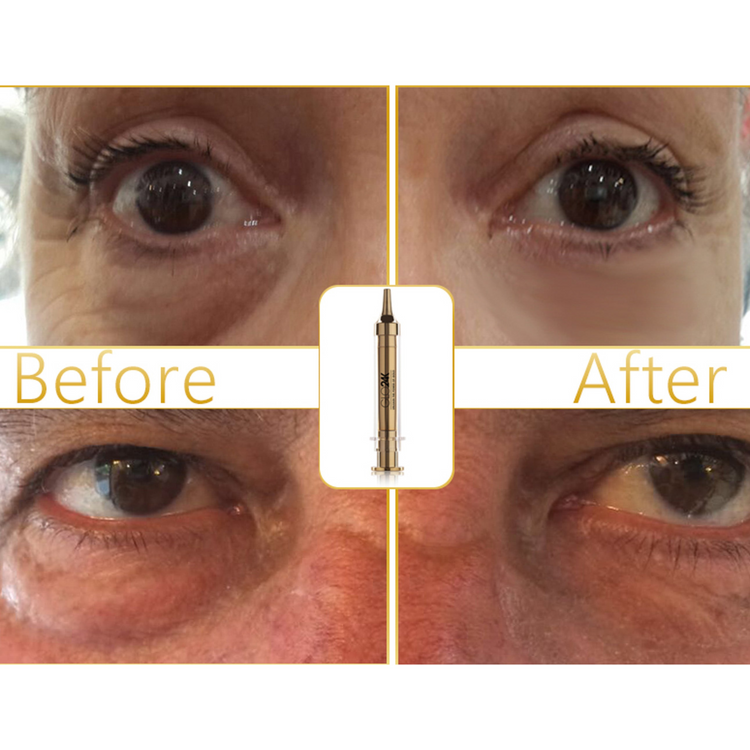 Express Non-Surgical Anti-Aging Facelift Cream