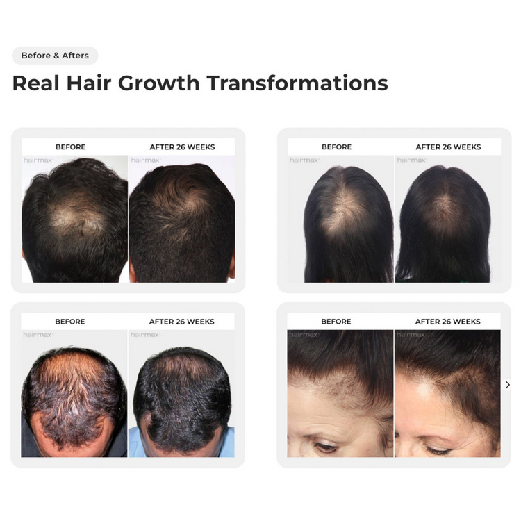 LaserBand 41 ComfortFlex - Blue