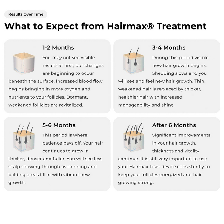 LaserBand 41 ComfortFlex - Blue