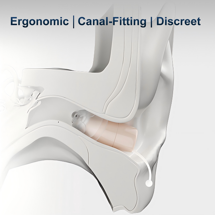 Ergonomic canal-fitting device with text on a white background
