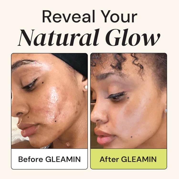 Before and after comparison of a person's face with text 'Reveal Your Natural Glow' and 'After GLEAMIN'.