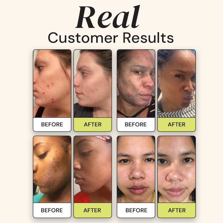 Before and after skin treatment results of multiple customers.