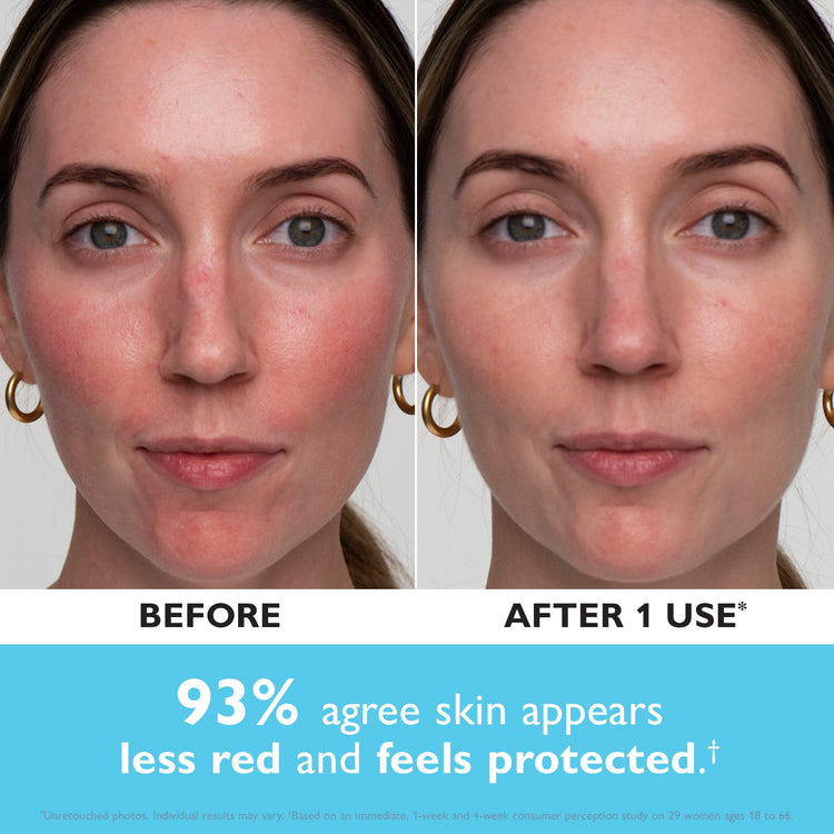 Before and after comparison of a woman's face with text indicating improvement in skin appearance.