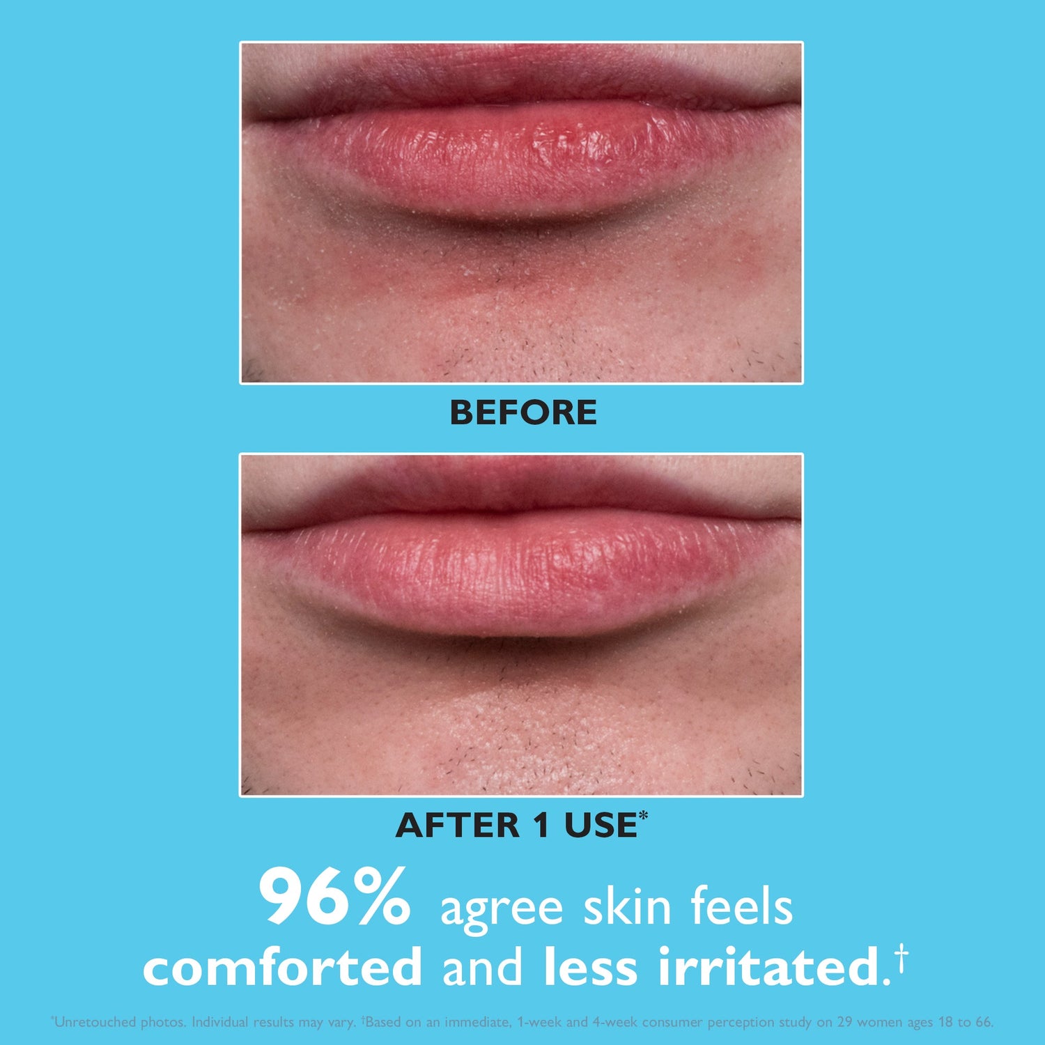 Before and after comparison of lips with text indicating comfort and irritation reduction.