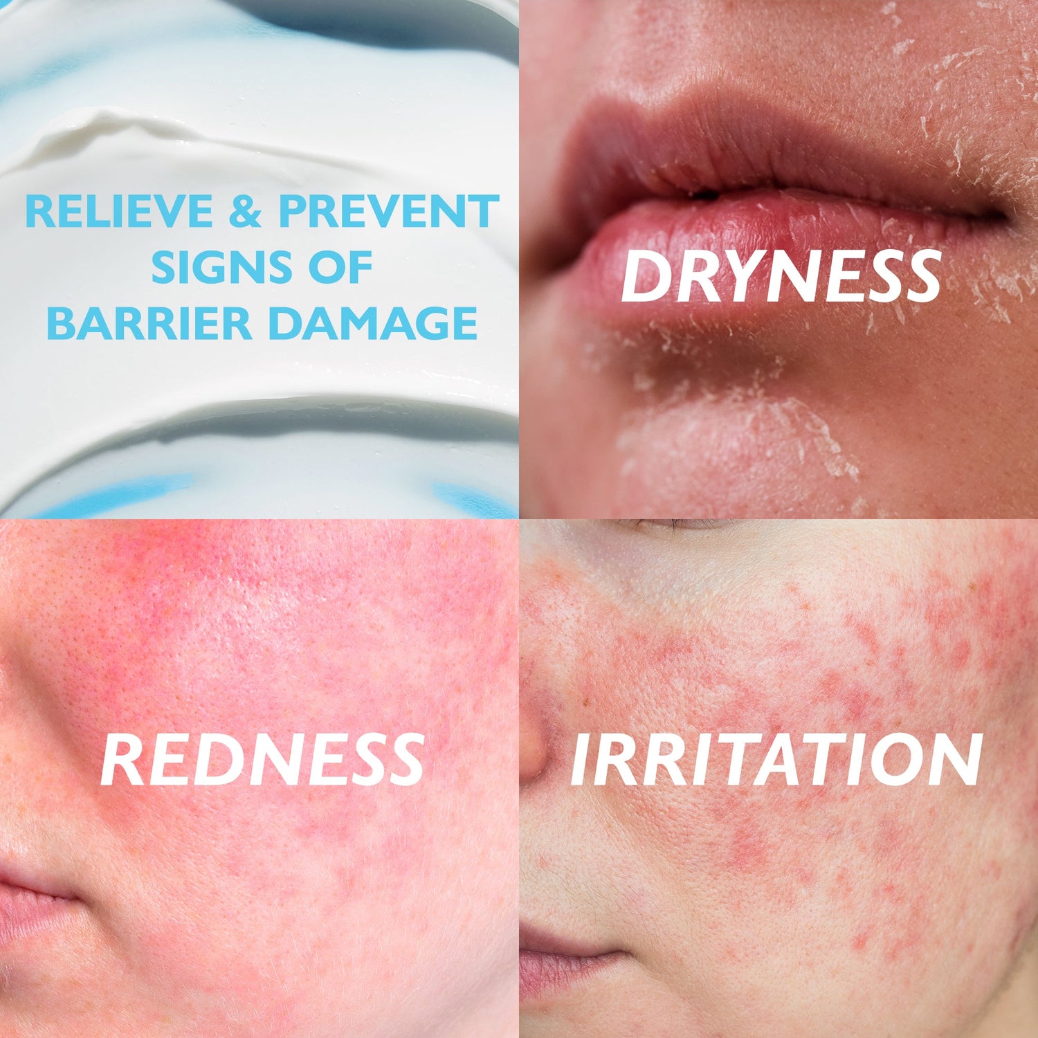 Collage of skin conditions with text on relieving and preventing barrier damage, dryness, redness, and irritation.