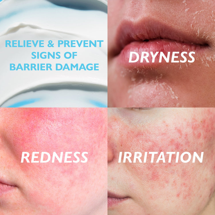 Collage of skin conditions with text on relieving and preventing barrier damage, dryness, redness, and irritation.