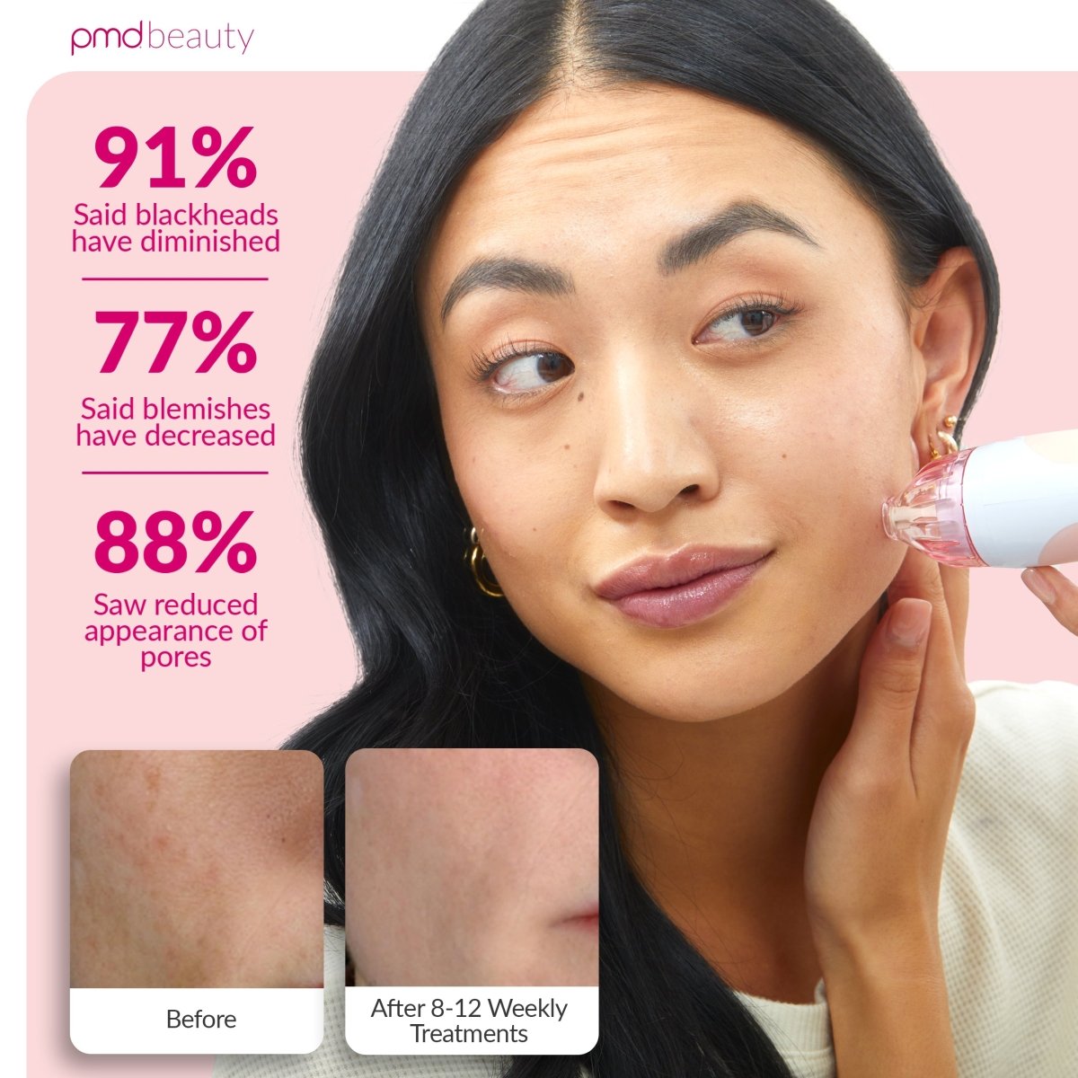 Woman using a skincare device with success statistics on a pink background