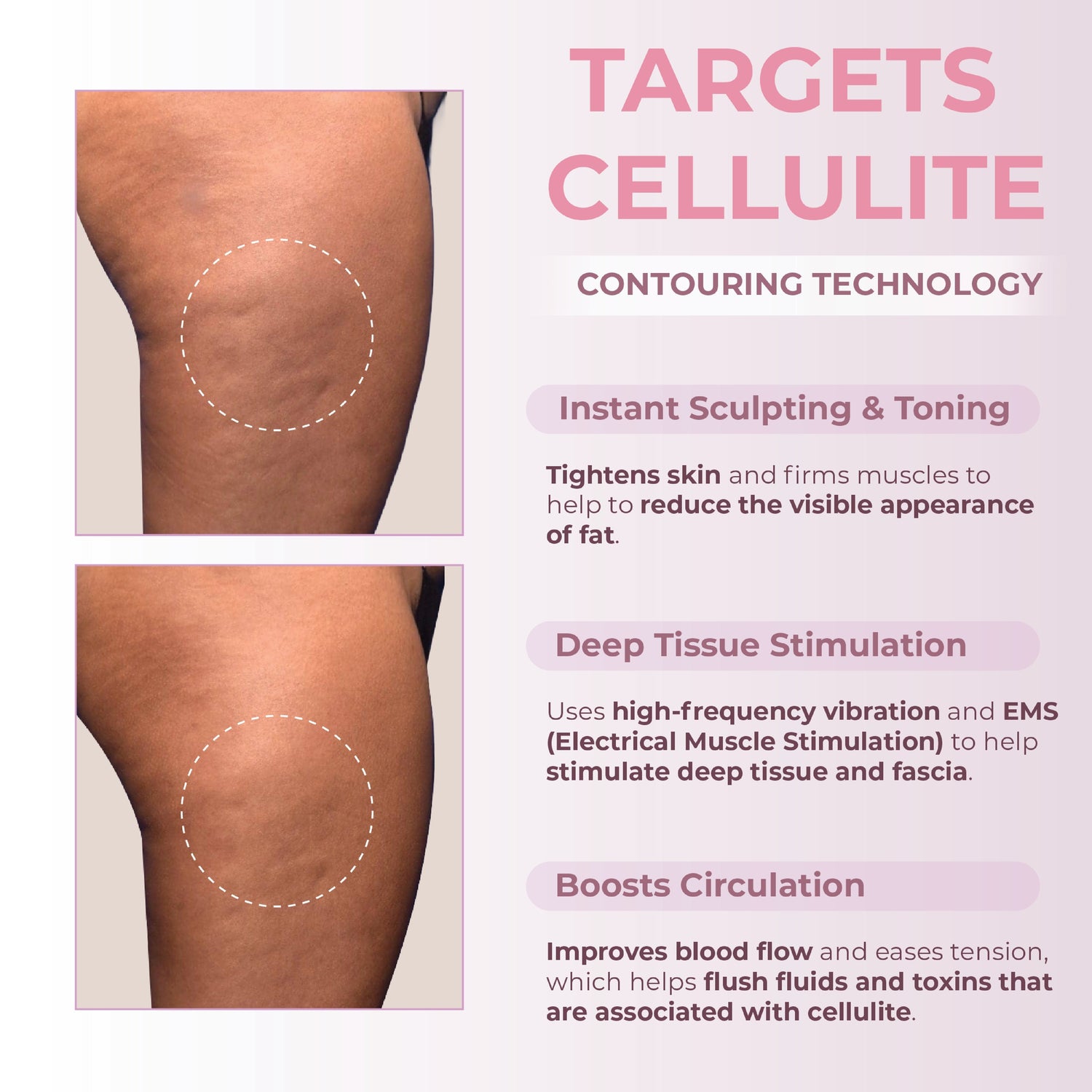 Advertisement for cellulite treatment with before and after images on a pink background.