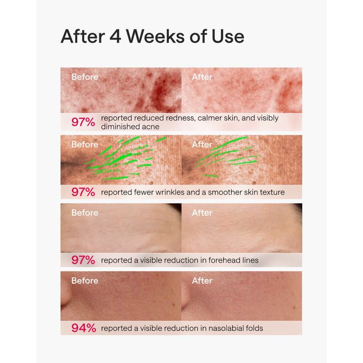 Before and after skin comparison showing improvements after 4 weeks of use.