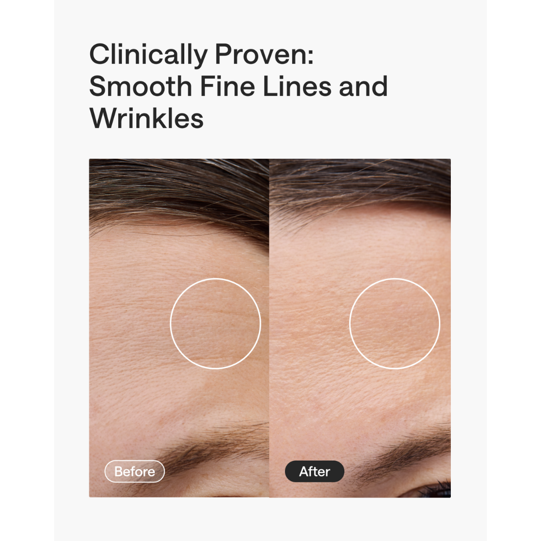 Before and after comparison of fine lines and wrinkles on skin with text 'Clinically Proven: Smooth Fine Lines and Wrinkles'.