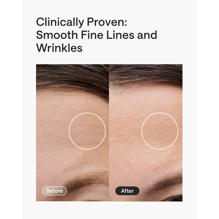 Before and after comparison of fine lines and wrinkles on skin with text 'Clinically Proven: Smooth Fine Lines and Wrinkles'.