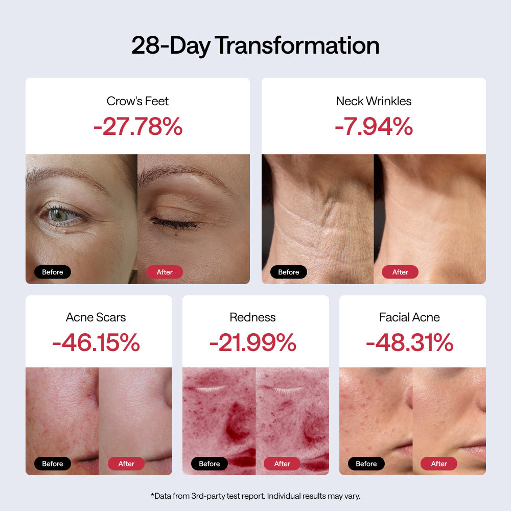 Before and after skin transformation results showing various issues with percentages.