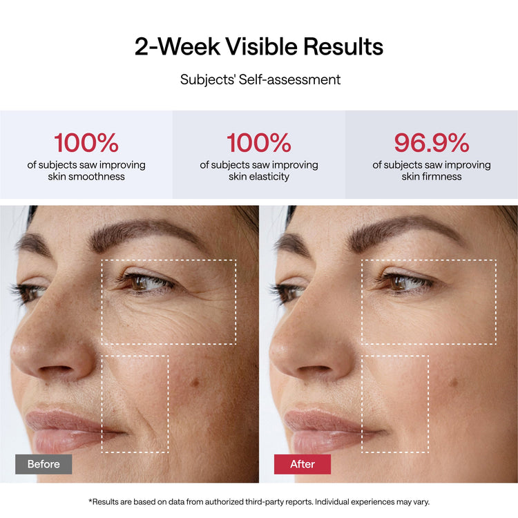 Before and after comparison of a woman's face with text on skin improvement results.