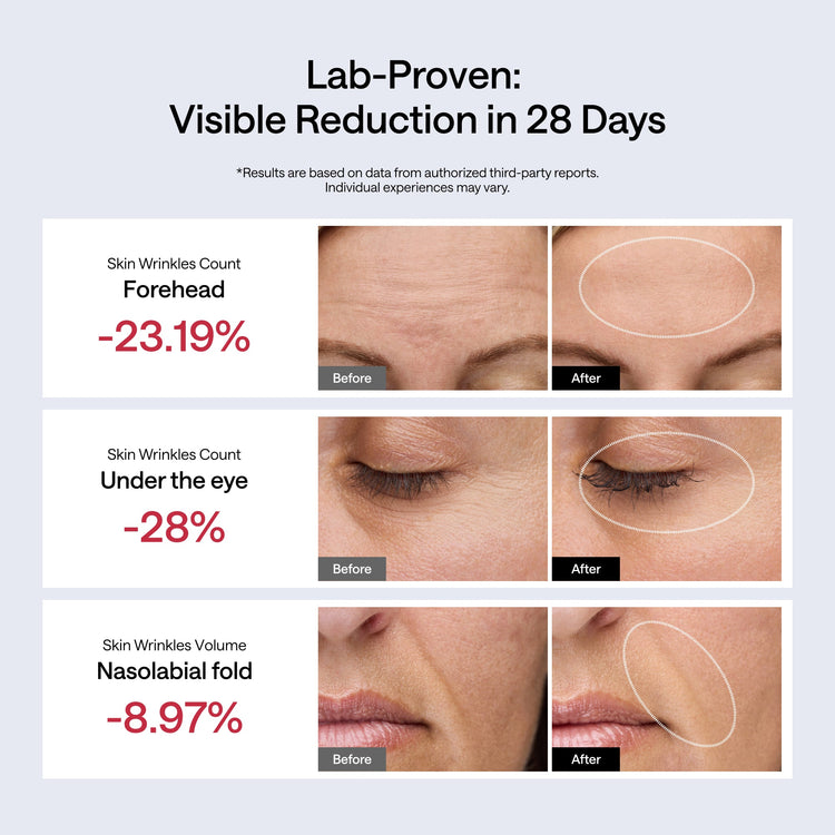 Before and after skin wrinkle reduction results on a person's face with lab-proven visible reduction in 28 days.