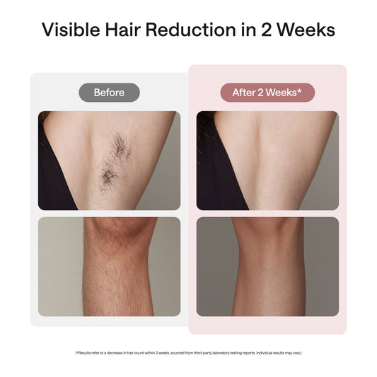 Rose gold Ulike Air 10 hair removal device with packaging on a white background