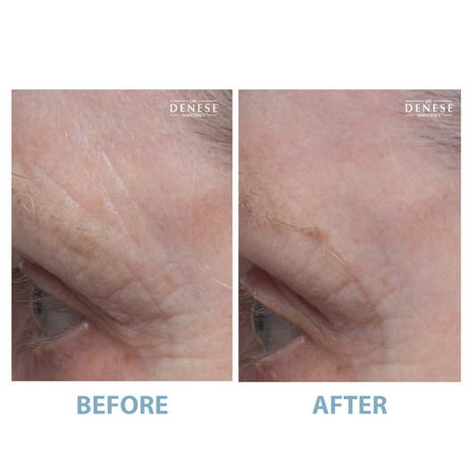 Dr. Denese Pro Strength Serum 2oz