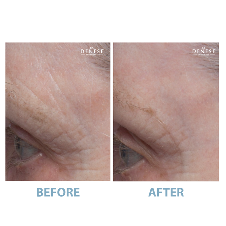 Dr. Denese Pro Strength Serum 2oz