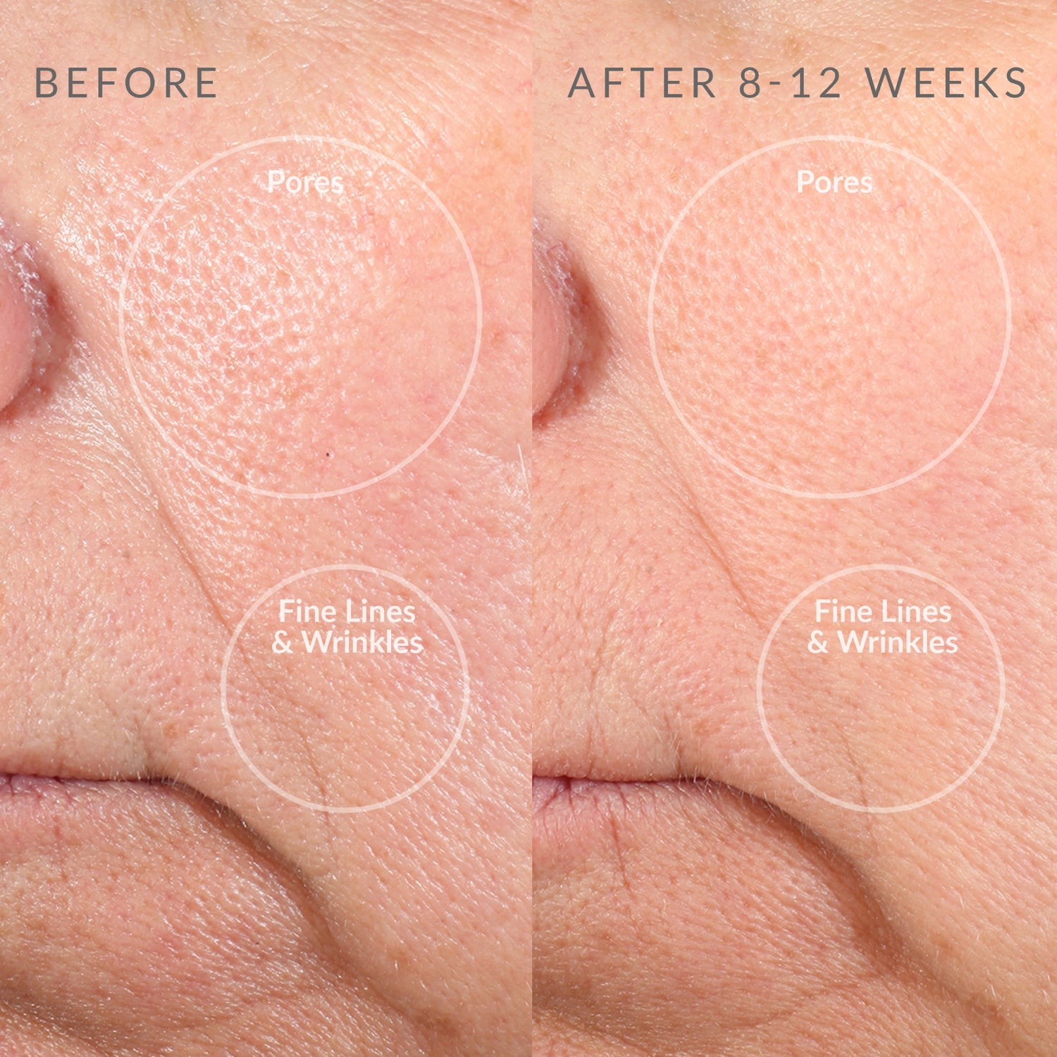Before and after comparison of skin with pores and fine lines on a close-up of skin.