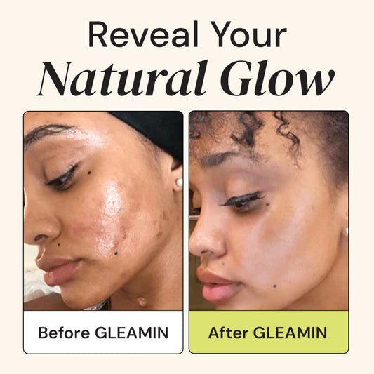 Gleamin skincare product set including cleanser, serum, oil, mask, and moisturizer on a white background.