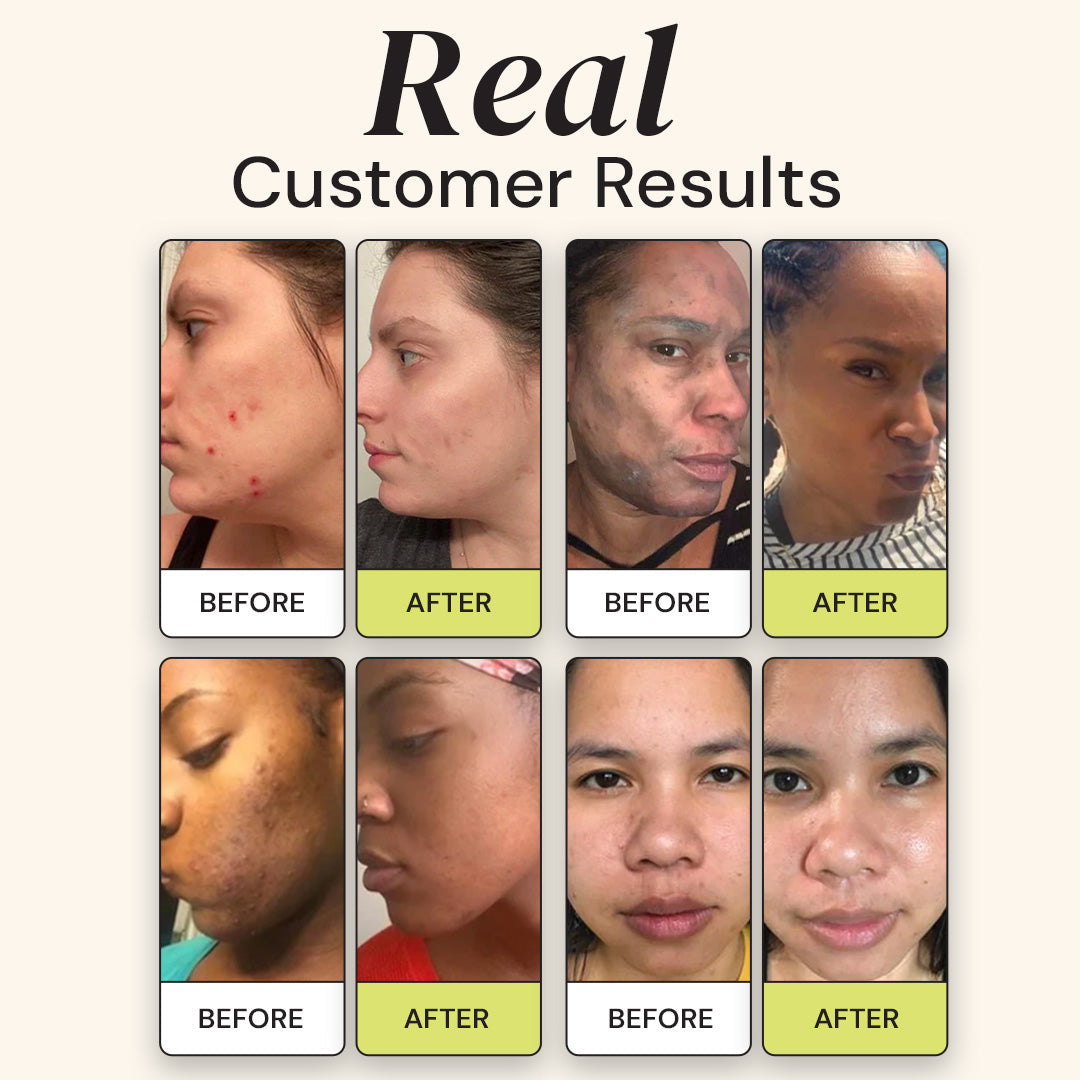 Before and after skin treatment results of multiple customers.