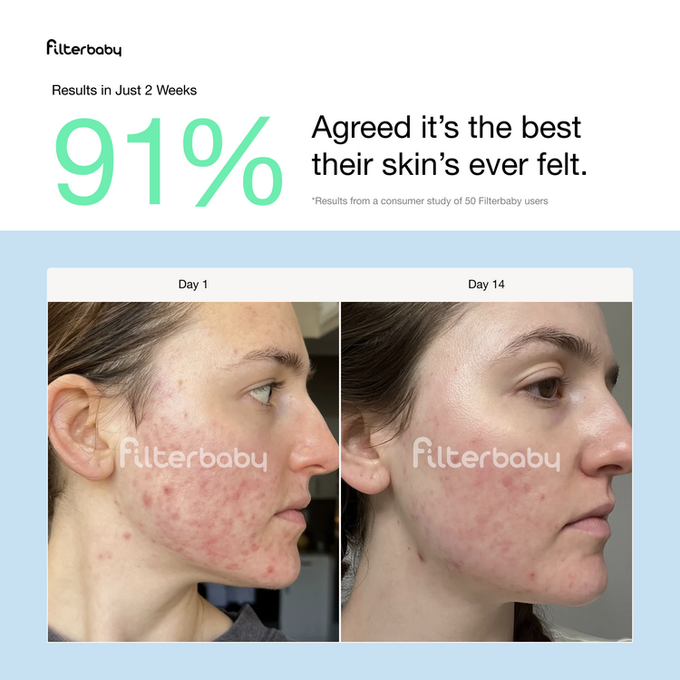 Skincare Faucet Filter
