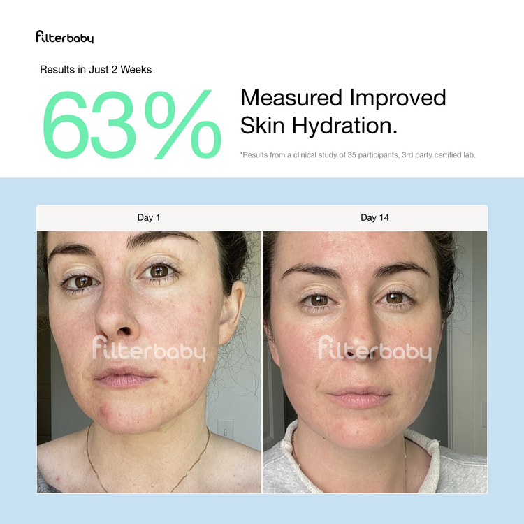 Skincare Faucet Filter