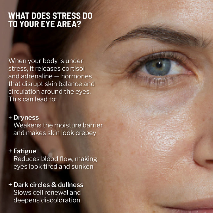 Close-up of a woman's eye with text explaining how stress affects the eye area.