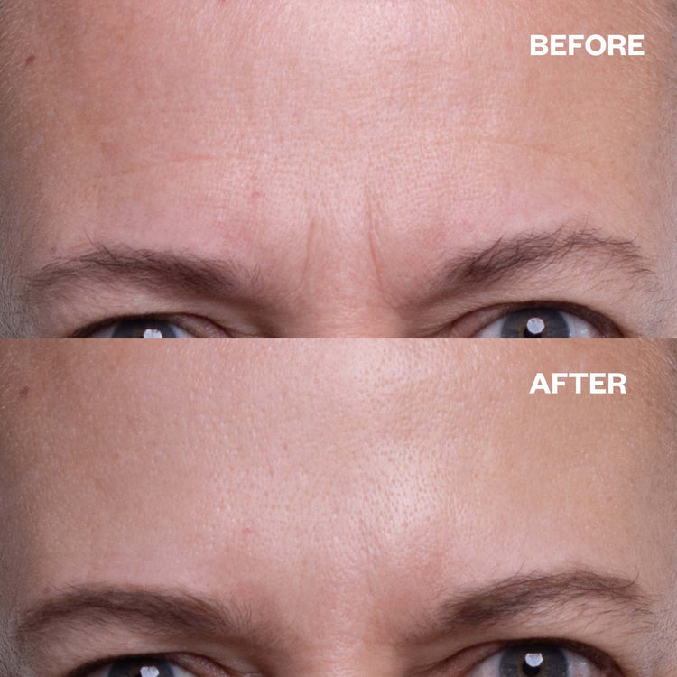 Summer Skin Recovery Set