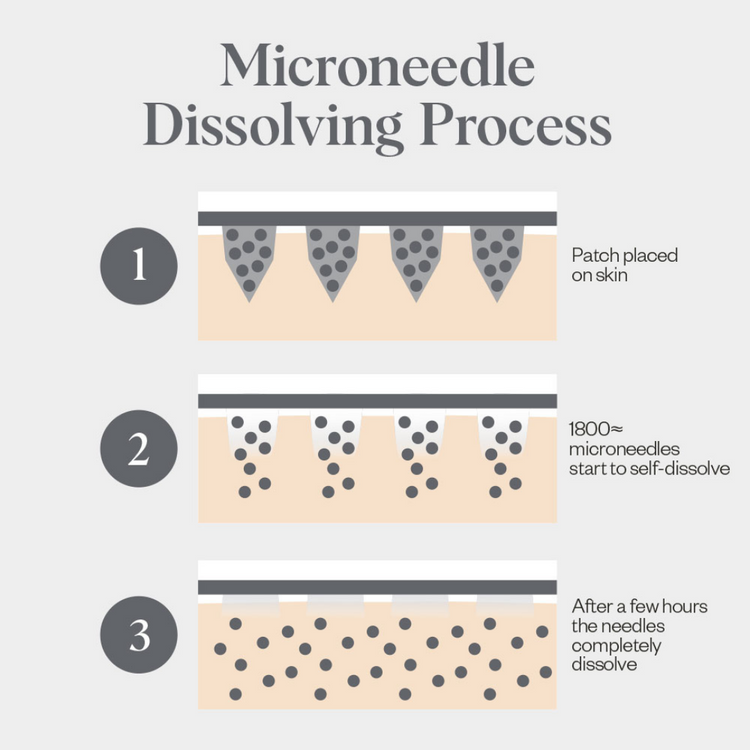 Self-Dissolving Microneedle Patches - 4 Pack