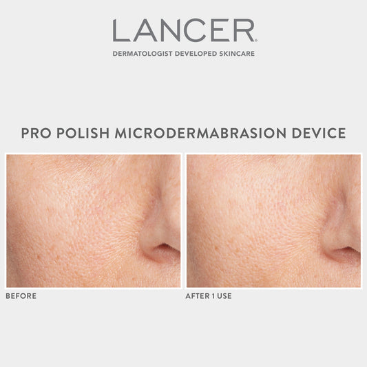 A person is using a pink microdermabrasion device on their leg in a bathroom setting.