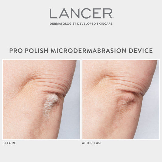 A person is using a pink microdermabrasion device on their leg in a bathroom setting.