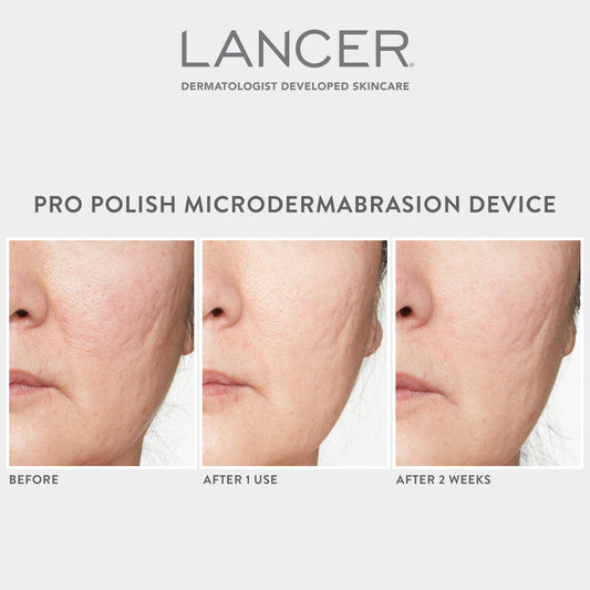 A person is using a pink microdermabrasion device on their leg in a bathroom setting.